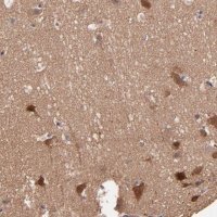 Anti-STAP2 antibody produced in rabbit HPA002375-100UL