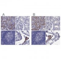 Anti-STAR antibody produced in rabbit