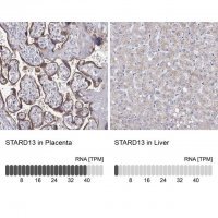 Anti-STARD13 antibody produced in rabbit 