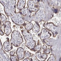 Anti-STARD13 antibody produced in rabbit 