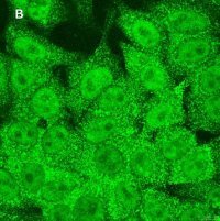 Anti-STAT1 (alpha & beta) clone 3G14 ZooMAb� Rabbit Monoclonal 