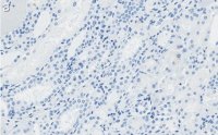 Anti-STAT1 (isoform alpha) Antibody, clone 1D4 ZooMAb® Rabbit Monoclonal