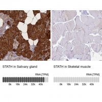 Anti-STATH antibody produced in rabbit 