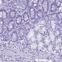 Anti-STATH antibody produced in rabbit 