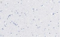 Anti-Stathmin-2 Antibody, clone 1B3 ZooMAb® Rabbit Monoclonal