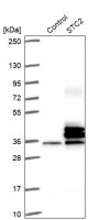 Anti-STC2 antibody produced in rabbit