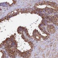 Anti-STC2 antibody produced in rabbit