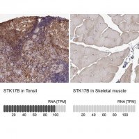 Anti-STK17B antibody produced in rabbit 