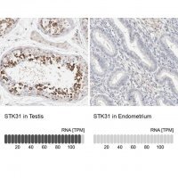 Anti-STK31 antibody produced in rabbit 