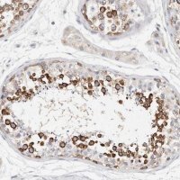 Anti-STK31 antibody produced in rabbit 