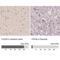 Anti-STK39 antibody produced in rabbit 