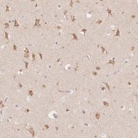 Anti-STK39 antibody produced in rabbit 