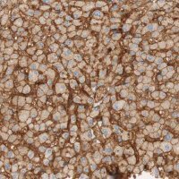Anti-STOM antibody produced in rabbit HPA010961-100UL