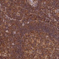 Anti-STOML1 antibody produced in rabbit 