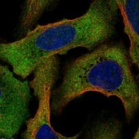 Anti-STRAP antibody produced in rabbit 