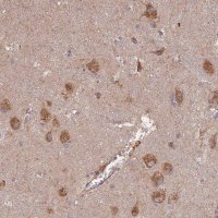 Anti-STX16 antibody produced in rabbit 