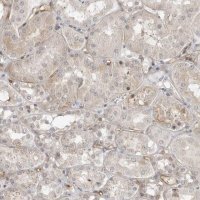 Anti-STXBP3 antibody produced in rabbit HPA027225-100UL