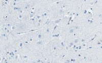 Anti-Substance P Antibody, clone 1K3 ZooMAb� Rabbit Monoclonal 