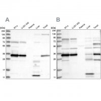 Anti-SUCLG1 antibody produced in rabbit