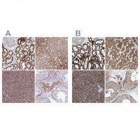 Anti-SUCLG2 antibody produced in rabbit 