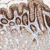 Anti-SULT1C2 antibody produced in rabbit HPA007190-100UL