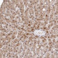 Anti-SULT1E1 antibody produced in rabbit HPA028213-100UL