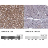 Anti-SULT2A1 antibody produced in rabbit 
