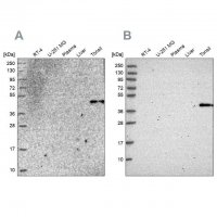 Anti-SULT2B1 antibody produced in rabbit 