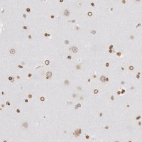 ANTI-SUN2 antibody produced in rabbit