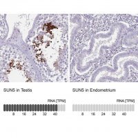 Anti-SUN5 antibody produced in rabbit 