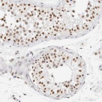 Anti-SUPT3H antibody produced in rabbit 