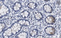 Anti-SUPV3L1 Antibody, clone 2F5 ZooMAb® Rabbit Monoclonal