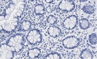 Anti-SUPV3L1 Antibody, clone 2F5 ZooMAb® Rabbit Monoclonal