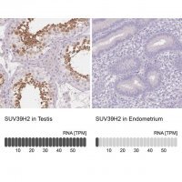 Anti-SUV39H2 antibody produced in rabbit 