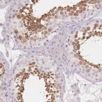 Anti-SUV39H2 antibody produced in rabbit