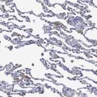 Anti-SVEP1 antibody produced in rabbit 