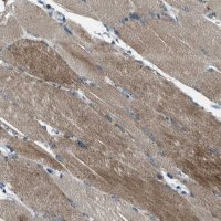 Anti-SVIL antibody produced in rabbit 