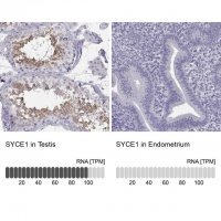 Anti-SYCE1 antibody produced in rabbit 