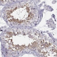 Anti-SYCE1 antibody produced in rabbit 