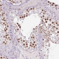 Anti-SYCE2 antibody produced in rabbit