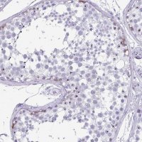 Anti-SYCP1 antibody produced in rabbit 
