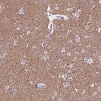 Anti-SYN1 antibody produced in rabbit HPA000397-100UL