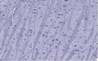 Anti-Synaptophysin Antibody, clone 1G7, ZooMAb� Rabbit Monoclonal 