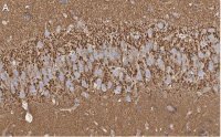 Anti-Synaptophysin Antibody, clone 2B21, ZooMAb� Rabbit Monoclonal 