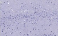 Anti-Synaptophysin Antibody, clone 2B21, ZooMAb� Rabbit Monoclonal 