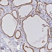 Anti-SYNCRIP antibody produced in rabbit 