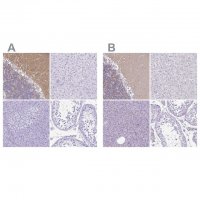 Anti-SYT1 antibody produced in rabbit 