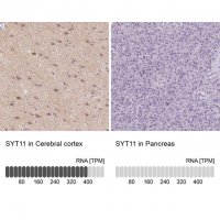 Anti-SYT11 antibody produced in rabbit