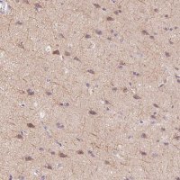 Anti-SYT11 antibody produced in rabbit