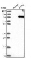 Anti-SYT16 antibody produced in rabbit HPA004199-100UL